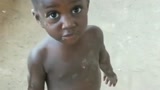非洲小孩的眼睛是真好看，这小孩的肚子为什么这么大？